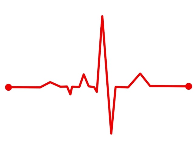 ECG